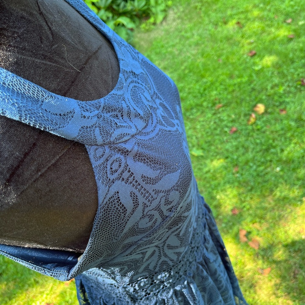 Charlotte Russe Blue Patterned Mini Dress - Picture 3 of 5